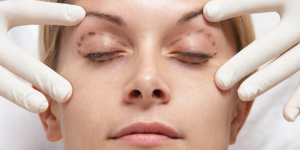 Blefaroplastia - Cirurgia plástica das pálpebras em Belo Horizonte